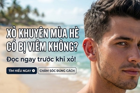 ok365 mùa hè có bị viêm không? Đọc ngay trước khi xỏ