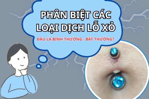 Xỏ khuyên: Phân biệt dịch tiết (vảy) và mủ nhiễm trùng