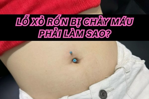 Xỏ khuyên rốn bị chảy máu phải làm sao?