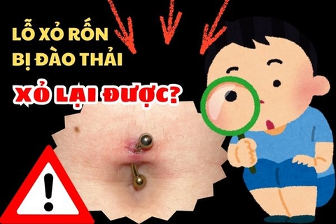 Xỏ khuyên rốn bị đào thải có xỏ lại được không?