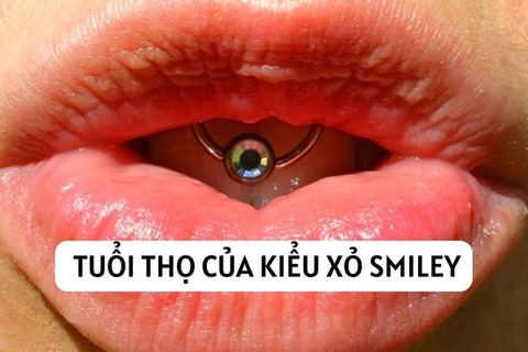 Xỏ khuyên Smiley chơi được bao lâu? 4 cách kéo dài tuổi thọ