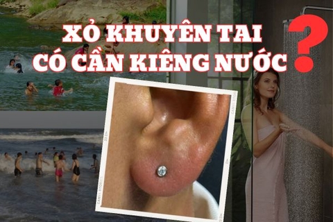 Xỏ khuyên tai có cần kiêng nước không và lưu ý bạn nên biết