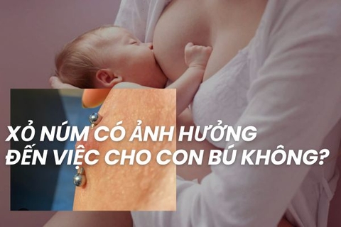 Xỏ núm vú có ảnh hưởng đến việc cho con bú không?