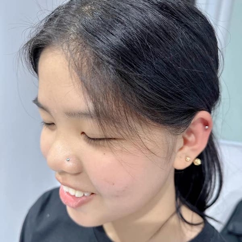 XỎ KHUYÊN CÁNH MŨI