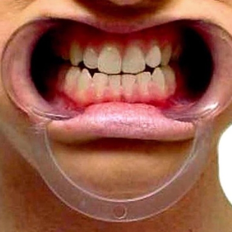 Dụng cụ banh miệng chữ C dùng trong nha khoa, chăm sóc răng miệng, làm trắng răng, đính đá