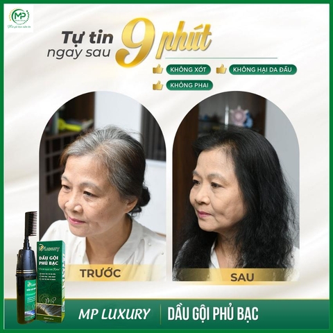 Sản phẩm 4