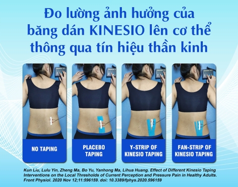 KINESIO TAPING CÓ THỰC SỰ TÁC ĐỘNG LÊN THẦN KINH NGOẠI VI NÔNG?