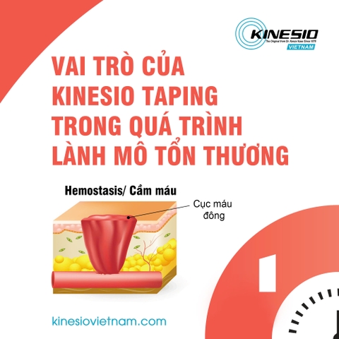 VAI TRÒ CỦA KINESIO TAPING TRONG QUÁ TRÌNH LÀNH MÔ TỔN THƯƠNG