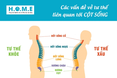 CÁC VẤN ĐỀ VỀ TƯ THẾ LIÊN QUAN TỚI CỘT SỐNG