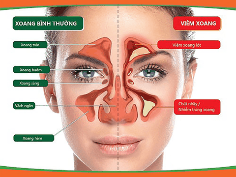 Xoang Tâm Đức 70ml