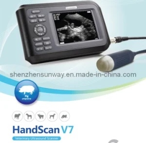 MÁY/THIẾT BỊ SIÊU ÂM THÚ Y SUNWAY HANDSCAN V7 CHO ĐỘNG VẬT (HEO, BÒ, DÊ, LỢN,...)