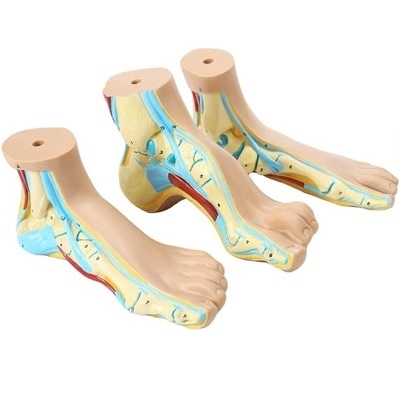 MÔ HÌNH BÀN CHÂN BỆNH LÝ - BÀN CHÂN THƯỜNG, BÀN CHÂN DẸT, BÀN CHÂN VÒM.