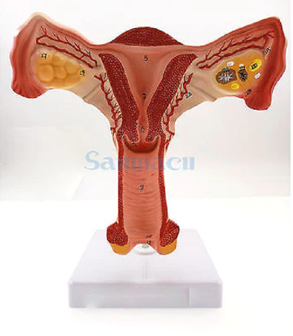 MÔ HÌNH GIẢNG DẠY BỆNH LÝ TỬ CUNG