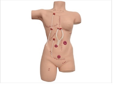 MÔ HÌNH CHĂM SÓC VẾT THƯƠNG SAU MỔ