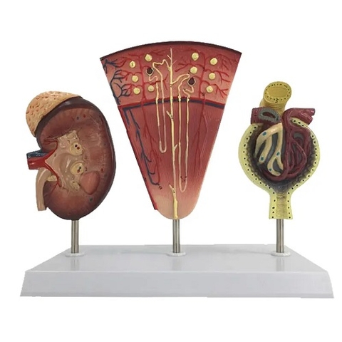 MÔ HÌNH GIẢI PHẪU THẬN VÀ CẦU THẬN