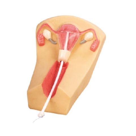 MÔ HÌNH THỰC HÀNH MÔ PHỎNG ĐẶT DỤNG CỤ TỬ CUNG GD/F5N