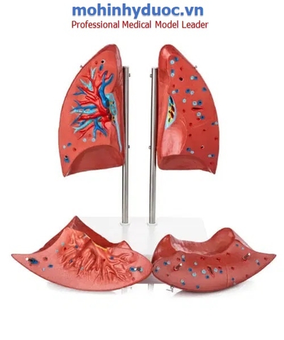 Mô hình phổi 4 Phần