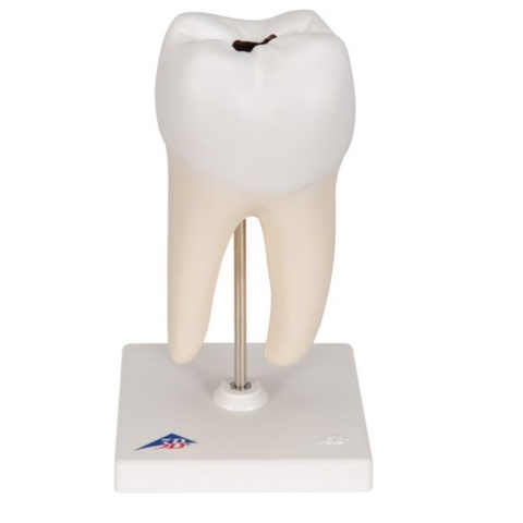 Mô Hình Răng Hàm 2 Chân – 1000243 – 3B Scientific