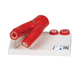 MÔ HÌNH XƠ CỨNG ĐỘNG MẠCH VỚI MẶT CẮT ĐỘNG MẠCH 2 PHẦN - 1000278 - 3B SCIENTIFIC