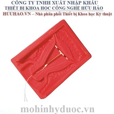 MÔ HÌNH ĐẶT DỤNG CỤ TỬ CUNG - NASCO