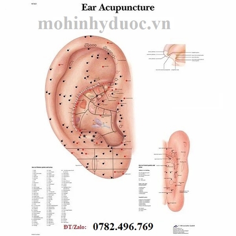 TRANH BIỂU ĐỒ CHÂM CỨU TAI - TRANH NHĨ CHÂM