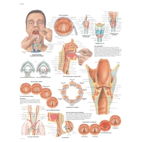 TRANH GIẢI PHẪU THANH QUẢN VR1248L