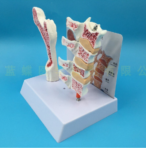 MÔ HÌNH CÁC GIAI ĐOẠN LOÃNG XƯƠNG