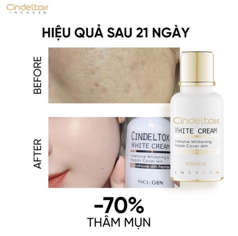 (HĐ) Kem Dưỡng Trắng Da Incugen Cindel Tox White Cream Premium mẫu mới