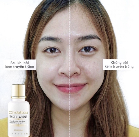 (HĐ) Kem Dưỡng Trắng Da Incugen Cindel Tox White Cream Premium mẫu mới
