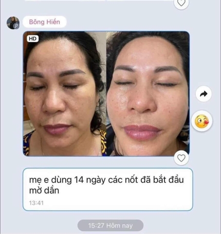 Kem dưỡng trắng trị nám Mela Q hiệu thuốc 50g (100ea)