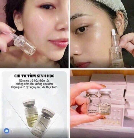 Chỉ tơ tằm esthemax chitossil (52ea)