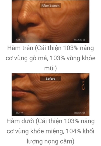 Kem nâng cơ cổ DCA Medilab daycell 50ml (80ea)