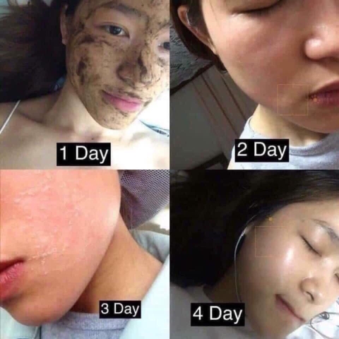 Thay da sinh học BQcell Derma skin peeling (60ea)