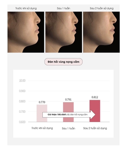 Kem nâng cơ cổ DCA Medilab daycell 50ml (80ea)