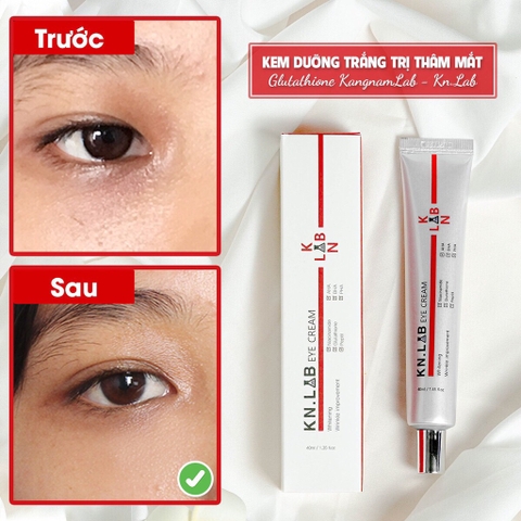 Kem dưỡng trắng trị thâm mắt Glutathione KangnamLab - Kn.Lab 40ml (100ea)