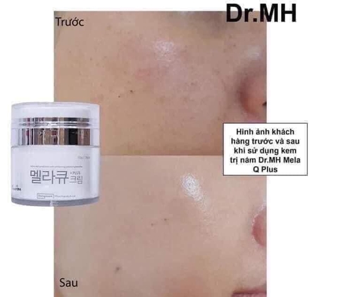 Kem trị nám tàn nhang MELA M - Dr.MH 50g (50ea)