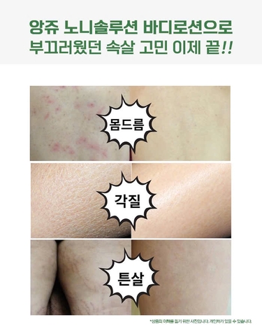 Sữa Dưỡng Thể Dưỡng Ẩm Sáng Mịn Da Từ Trái Nhàu Anjo Noni Therapy Body Lotion 750ml