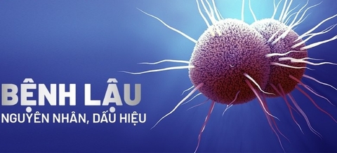 Các Giai Đoạn Của Bệnh Lậu: Triệu Chứng Theo Từng Giai Đoạn Và Cách Điều Trị
