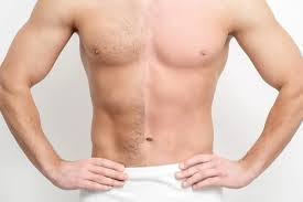 Nam Giới Có Nên Tỉa Lông Vùng Kín Không? Lợi Ích, Rủi Ro Và Cách Làm An Toàn