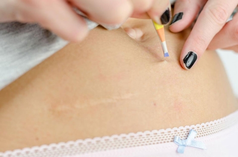 Nhổ Lông Vùng Kín Có Sao Không? Lợi Ích, Rủi Ro Và Cách Làm An Toàn