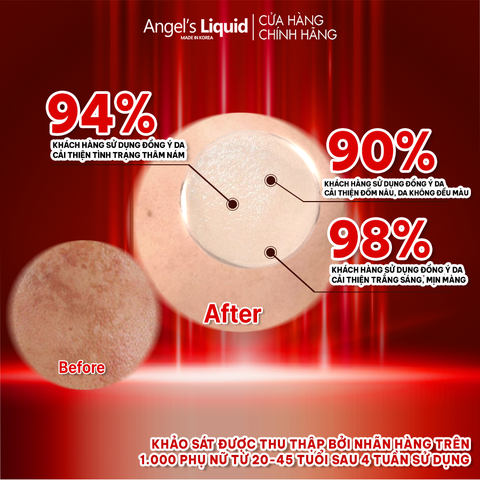 Kem Angel's Liquid 7Day Whitening Program Glutathione 700 V-Cream Dưỡng Trắng Da 50ml