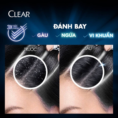 Dầu Gội Clear Sạch Gàu 410ml
