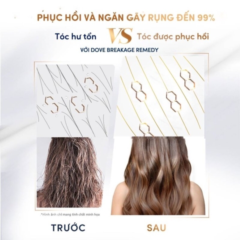 Dầu Gội Dove Phục Hồi & Ngăn Gãy Rụng Hair Therapy Breakage Remedy Shampoo 380ml