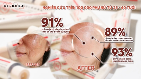 Kem Dưỡng Beldora 299 Retinol Tái Tạo, Ngăn Ngừa Nếp Nhăn, Phủ Bóng, Ngừa Mụn 35ml