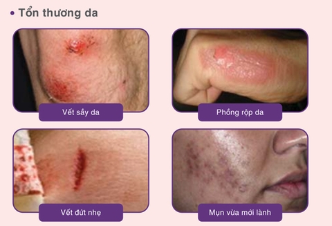 Kem Dưỡng Bioderma Cicabio Creme+ Phục Hồi Da Tổn Thương Và Ngừa Sẹo