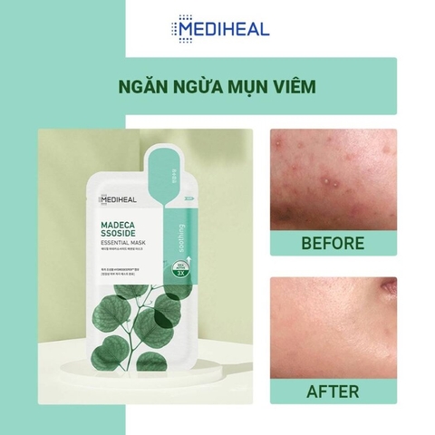 Mặt Nạ Mediheal Essential Mask Dưỡng Da Chắc Khỏe 24ml
