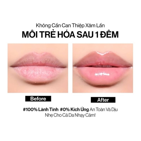 Mặt Nạ Ngủ Môi Glamrr Q Hỗ Trợ Làm Trẻ Hóa 10ml