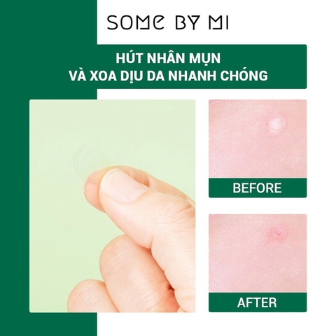 Miếng Dán Mụn Some By Mi Clear Spot Patch 18 Miếng