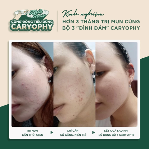 Serum Caryophy Portulaca Ampoule Giảm Mụn Mờ Thâm Se Lỗ Chân Lông 30ml