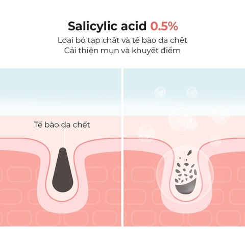 Sữa Rửa Mặt Cosrx Cho Da Dầu Mụn Salicylic Acid Daily Gentle Cleanser